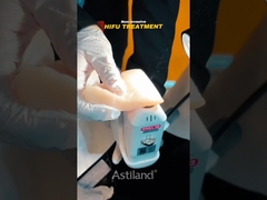 Il est possible de vérifier la puissance de levage non invasive du HIFU.