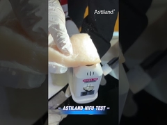 Test énergétique HIFU