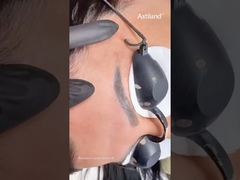 Laser Nd Yag pour l'effacement des tatouages de sourcils #laserndyag #effacementdetatouage #appareildebeauté #cliniquelasers