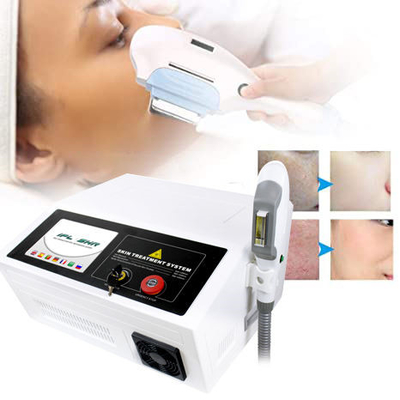 Machine de laser de peau de chargement initial d'épilation pour le traitement de pigmentation d'acné de rajeunissement de peau