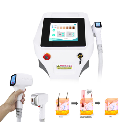 Vague permanente 808nm de Nova Ice Diode Laser Machine 3 d'épilation
